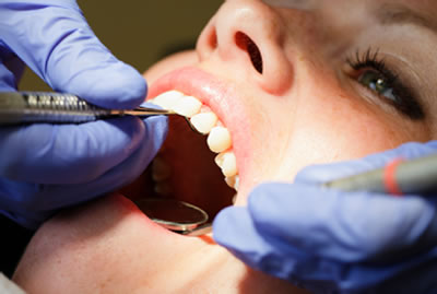 Gum Treatments - image of woman 